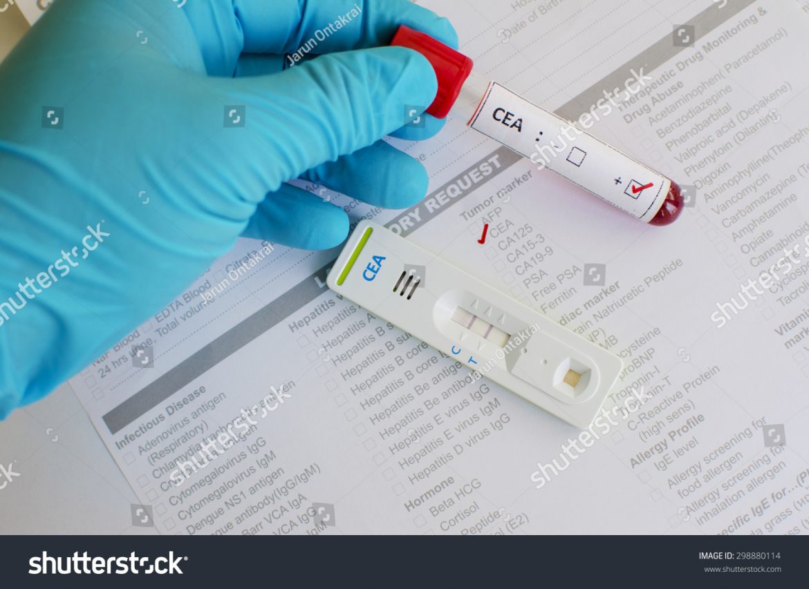 83% de los jóvenes se informa de VIH a través de las redes sociales